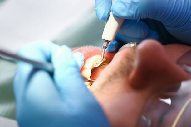 Best Emergency Tooth Extraction in East Providence, RI