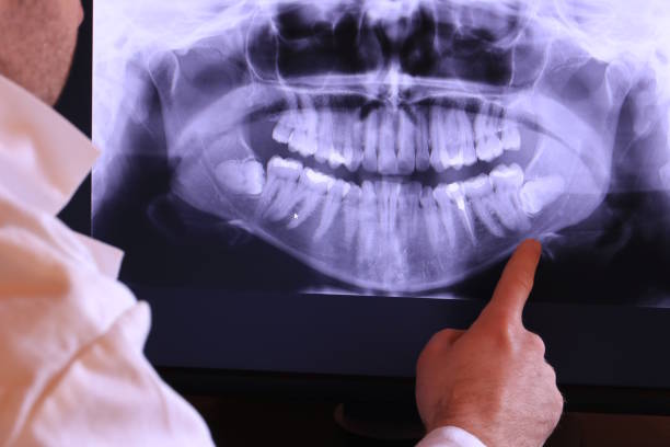 Best Emergency Treatment for Toothache in East Providence, RI